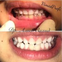 Профессиональная лечение зубов от доктора Алиева Захида